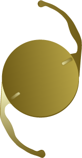 Standard Monofocal Lens