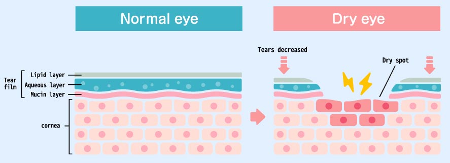 Tear Film Illustration